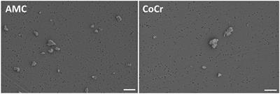 Inflammatory Response of Human Peripheral Blood Mononuclear Cells and Osteoblasts Incubated With Metallic and Ceramic Submicron Particles